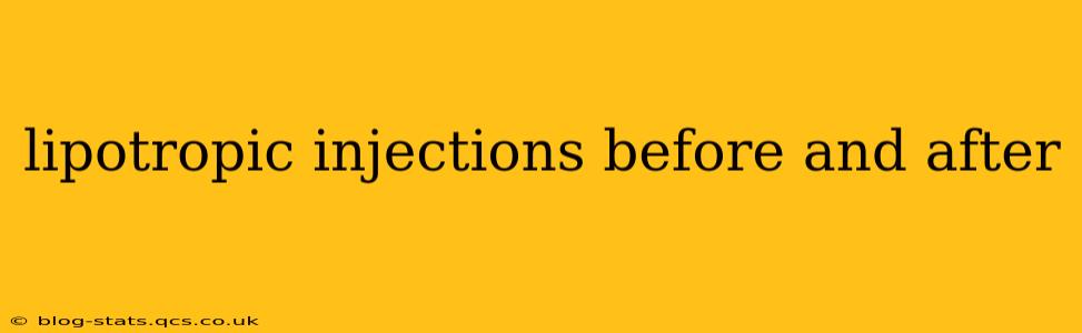 lipotropic injections before and after