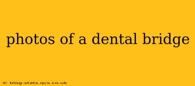 photos of a dental bridge